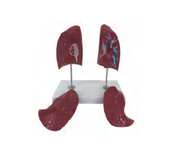 肺解剖模型（4部件）