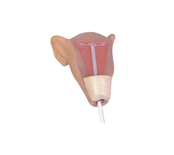 宫内避孕器训练模型I