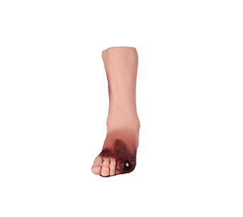 Diabetic foot teaching simulator