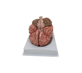 Brain and cerebral arteries (2 parts)