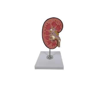 Kidney and Kidney Stone Anatomical Model