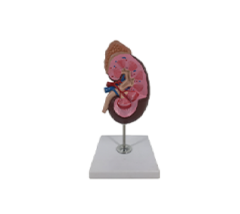 1.5x magnification of kidney anatomy with adrenal gland model