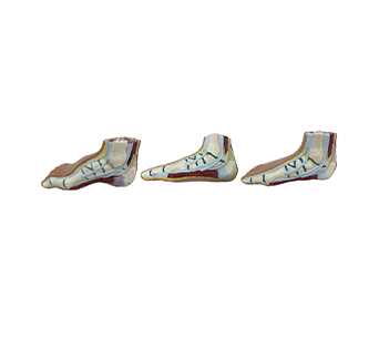 Natural large normal foot, flat foot, high arched foot simulator