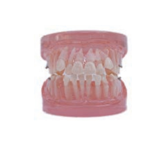 Orthodontic model